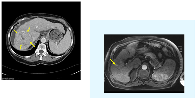           Computertomographie (CT) und Magnetresonanztomographie (MRT, NMR)